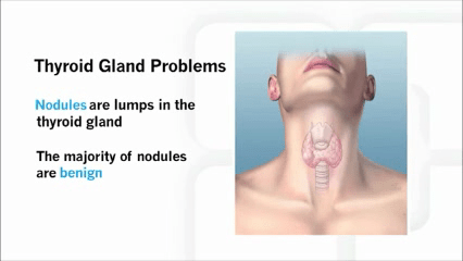 Thyroid biopsy
