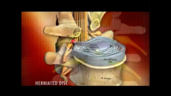 Ozonucleolysis