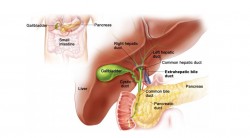 Biliary Interventions