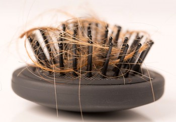 آیا بیماری تیروئید باعث ریزش مو می شود؟