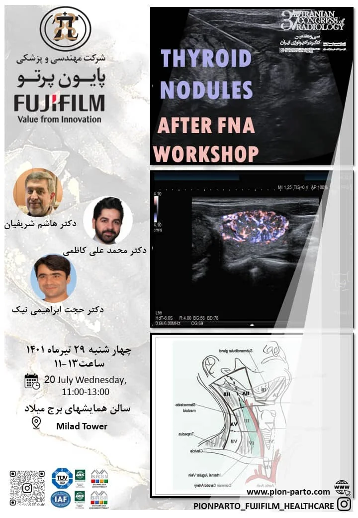 ورکشاپ-ندول-تیروئید-بعد-از-FNA