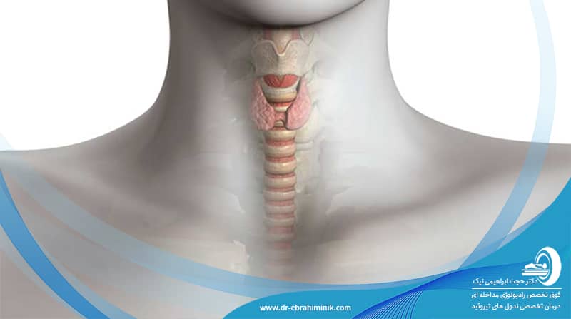 پرکاری تیروئید پرکاری تیروئید